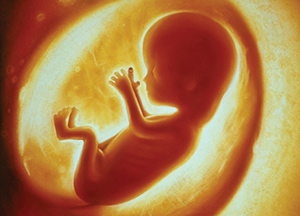Pain and Horror of Abortion Training